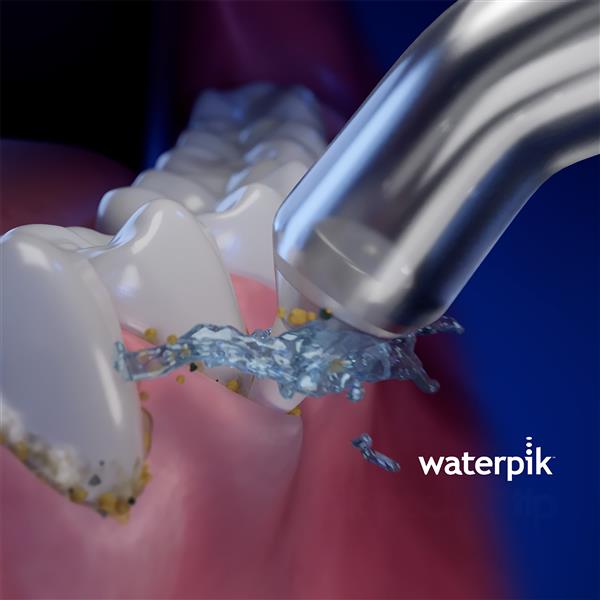 Verwendung PP-70E Pik Pocket™ Subgingivaldüse