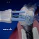 Verwendung WPS-2E Whitening Plaque Seeker™ Düse