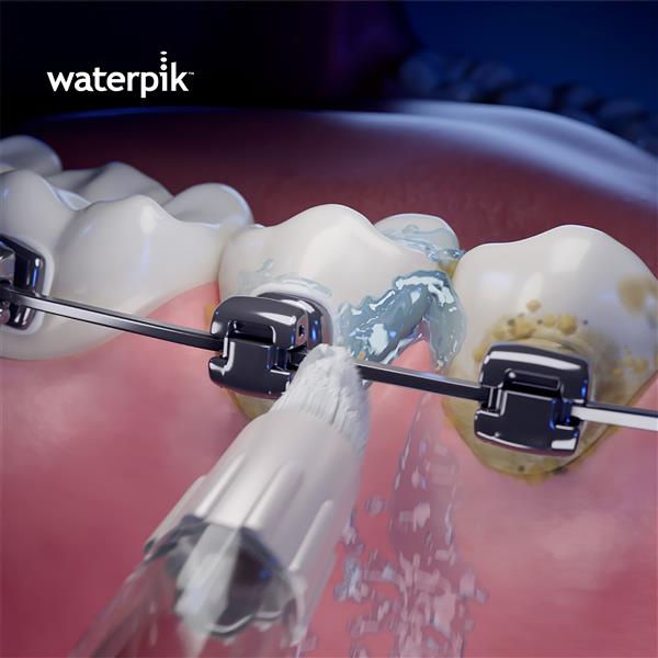 Verwendung OD-100E Orthodontic Düse