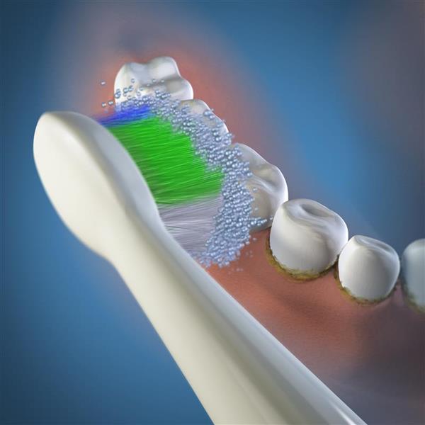 Verwendung SRRB-3E Sensonic Zahnbürste Standardbürstenkopf